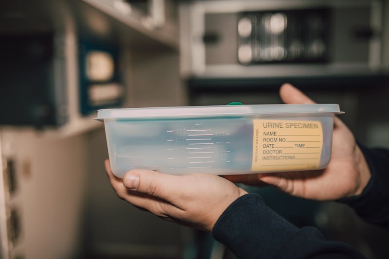 Hands holding a urine specimen container